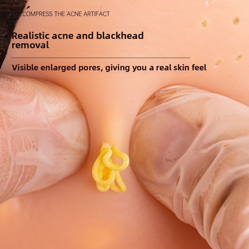 Stress Relief Artifact Pimple Squeezing Toy Big Head Blackhead Acne Nose Simulation Model Stress Relief Doll Toy