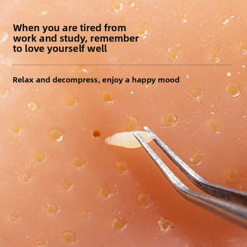 Decompression Artifact Strawberry Nose Clip Acne Simulation Extrusion Acne Decompression Toy Blackhead Cleaning Model Small Toy Model