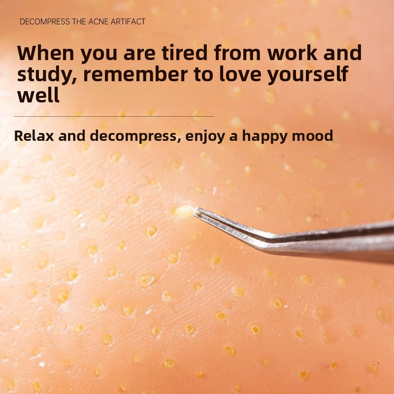 Stress Relief Artifact Pimple Squeezing Toy Big Head Blackhead Acne Nose Simulation Model Stress Relief Doll Toy