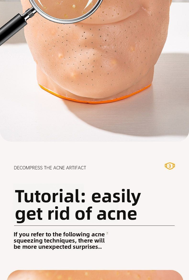 Stress Relief Artifact Pimple Squeezing Toy Big Head Blackhead Acne Nose Simulation Model Stress Relief Doll Toy