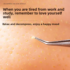 Stress Relief Artifact Pimple Squeezing Toy Big Head Blackhead Acne Nose Simulation Model Stress Relief Doll Toy