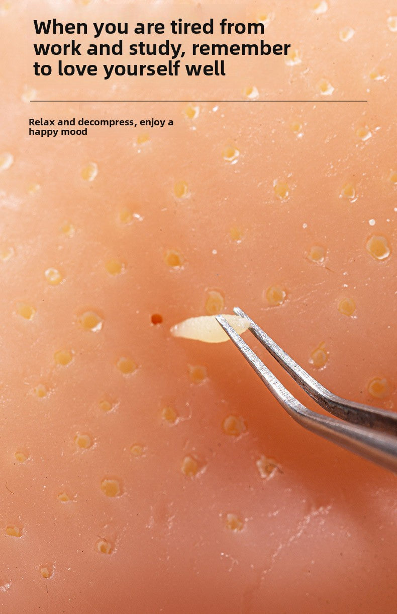 Decompression Artifact Strawberry Nose Clip Acne Simulation Extrusion Acne Decompression Toy Blackhead Cleaning Model Small Toy Model